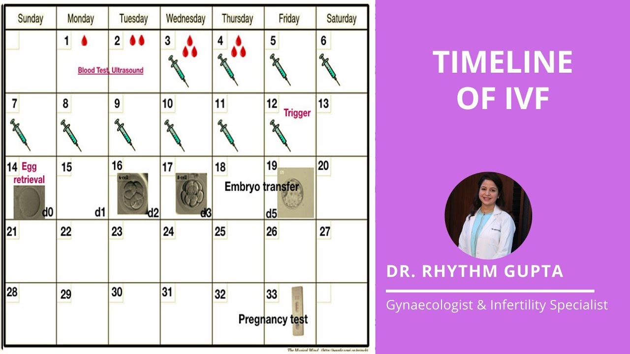 Timeline of IVF Explained Correctly | Dr Rhythm Gupta - Fertility Specialist