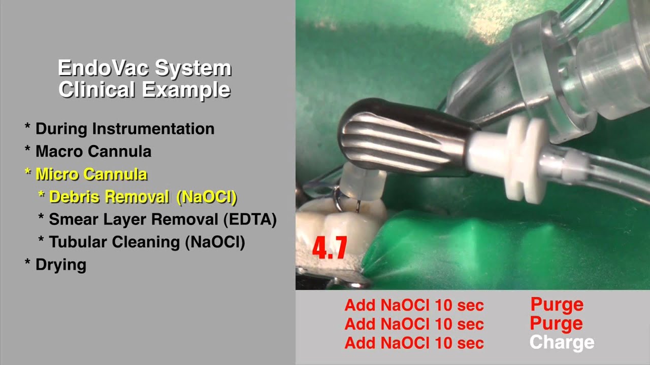 EndoVac - #3 Clinical Example