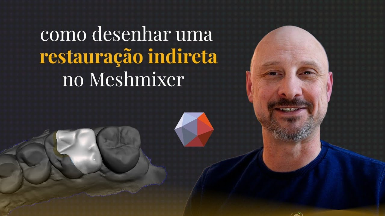 Aprenda a Criar Inlay, Onlay ou Overlay no Meshmixer com STL: Odontologia Digital Sem Segredos