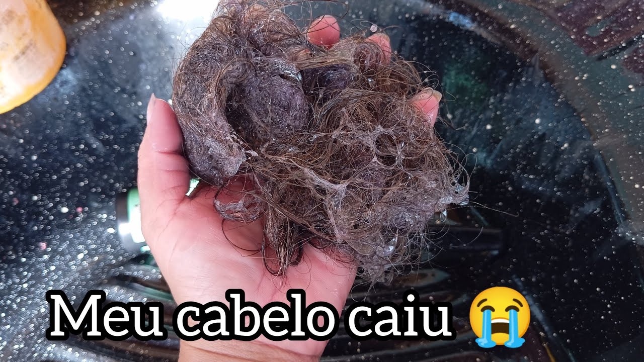 MEU CABELO CAIU O QUE ACONTECEU  ? 