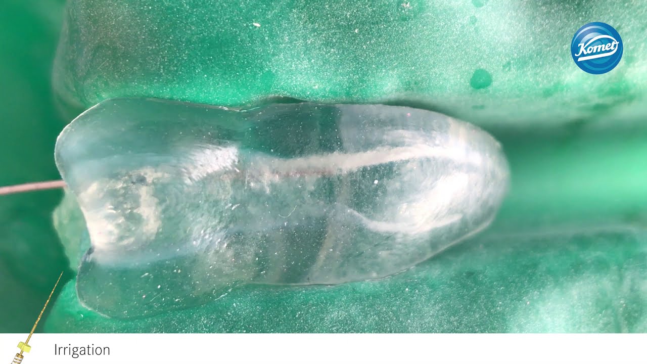 PathGlider - lime de cathétérisme mécanisée