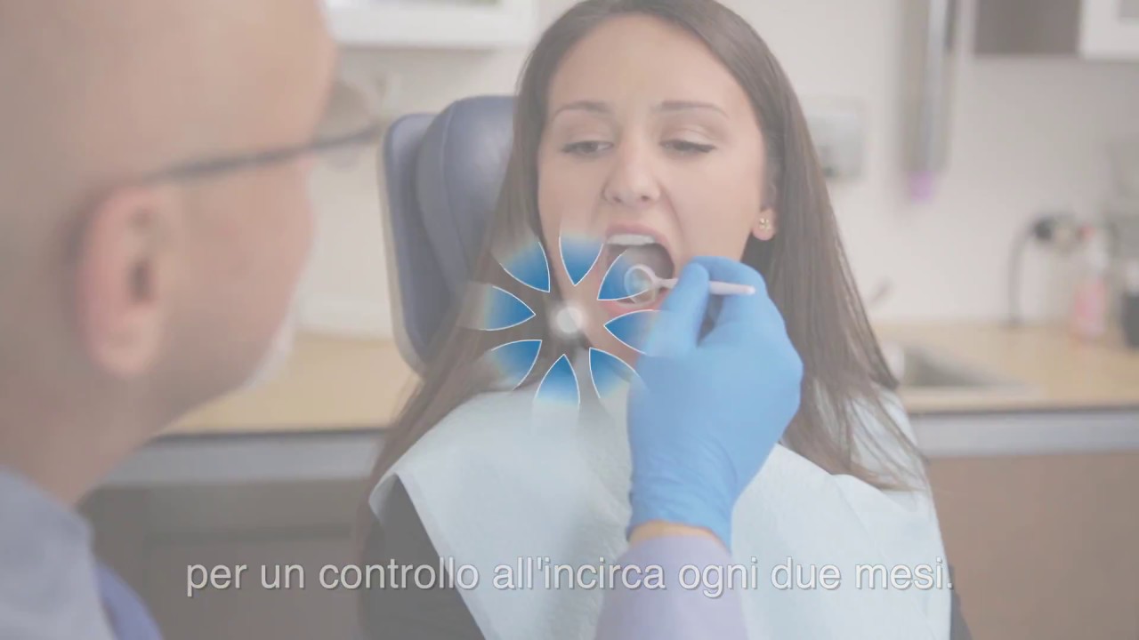 Invisalign: cos'è come funziona e fa al caso mio 2016?