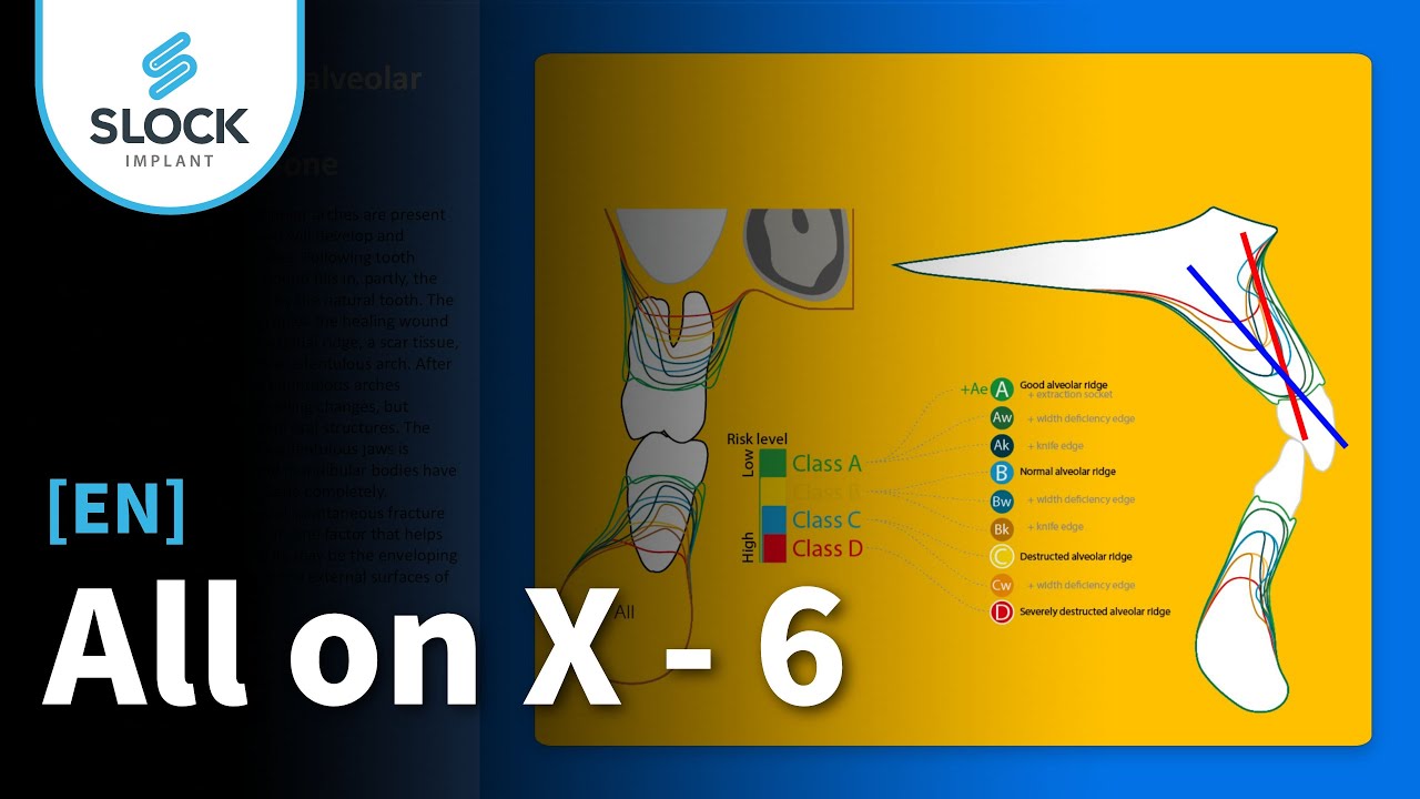 [EN dub / RU sub] AllonX - 6