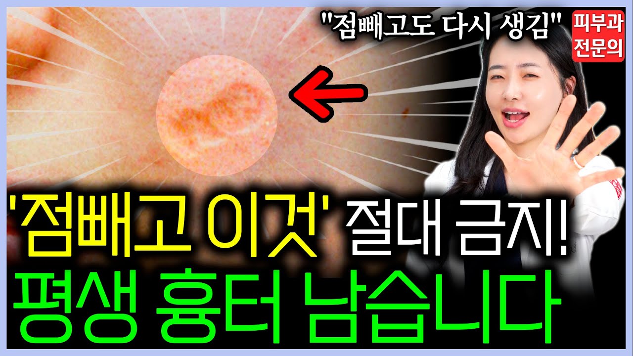 '점 빼고' 흉터 색소침착 남지 않는 후관리 방법 피부과 전문의가 알려드립니다 l 이 5가지는 절대 하지마세요