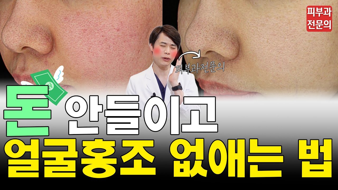 🔥안면홍조🔥주사피부염, 민감피부까지 도저히 개선이 안 되시나요?  | 관리법 & 식이요법 & 치료법 | 세브란스피부과 교수가 알려드립니다.