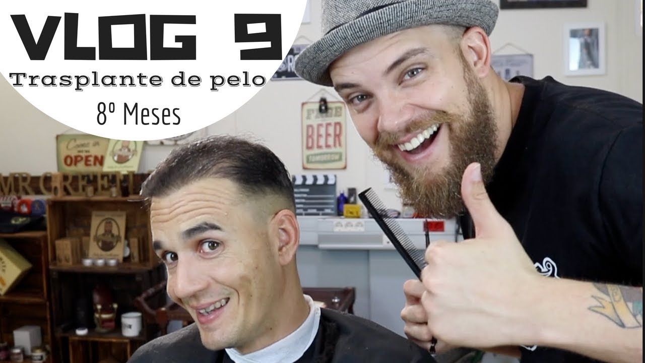 VLOG 9 TRASPLANTE DE PELO  8º MESES CON NUESTRO TRASPLANTE DE PELO