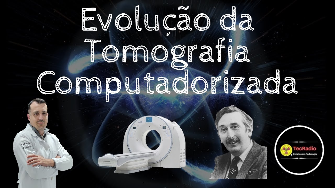 EVOLUÇÃO DA TOMOGRAFIA COMPUTADORIZADA