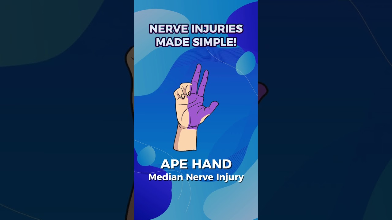 🧠 Mastering Nerve Injuries Simplified!