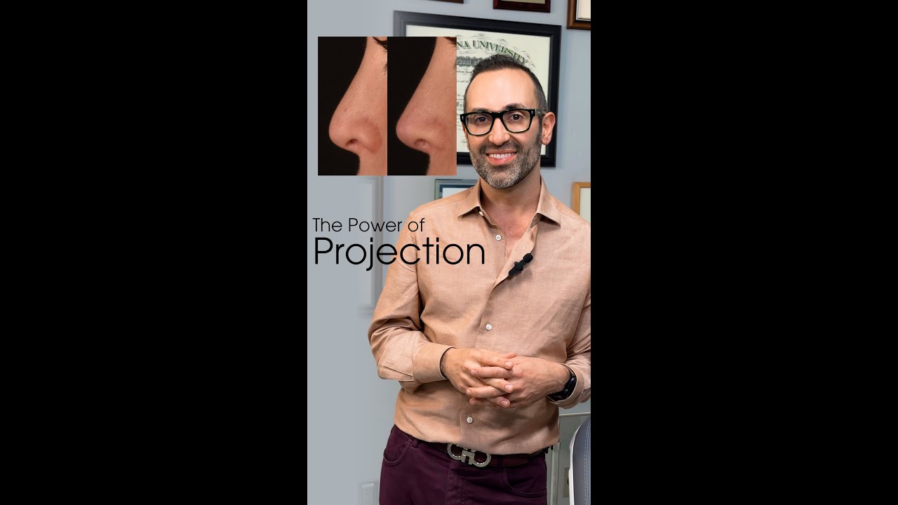 The Power of Projection in Cosmetic Rhinoplasty with Dr. Kian