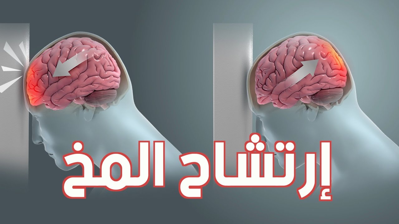 ارتفاع ضغط المخ الحميد ( ورم المخ الكاذب )