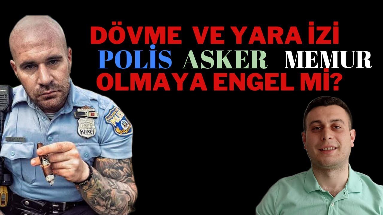 DÖVME VE KESİK İZİ ASKER VE POLİS OLMAYA ENGEL Mİ