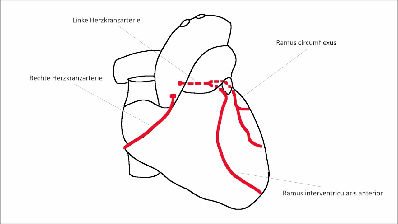 EKG verstehen; Schenkelblock, Herzinfarkt (EKG Crashkurs Teil 2)