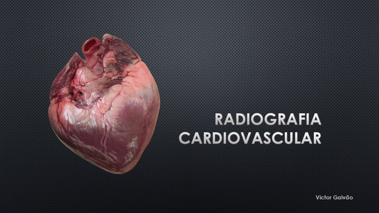 Radiografia Cardiovascular