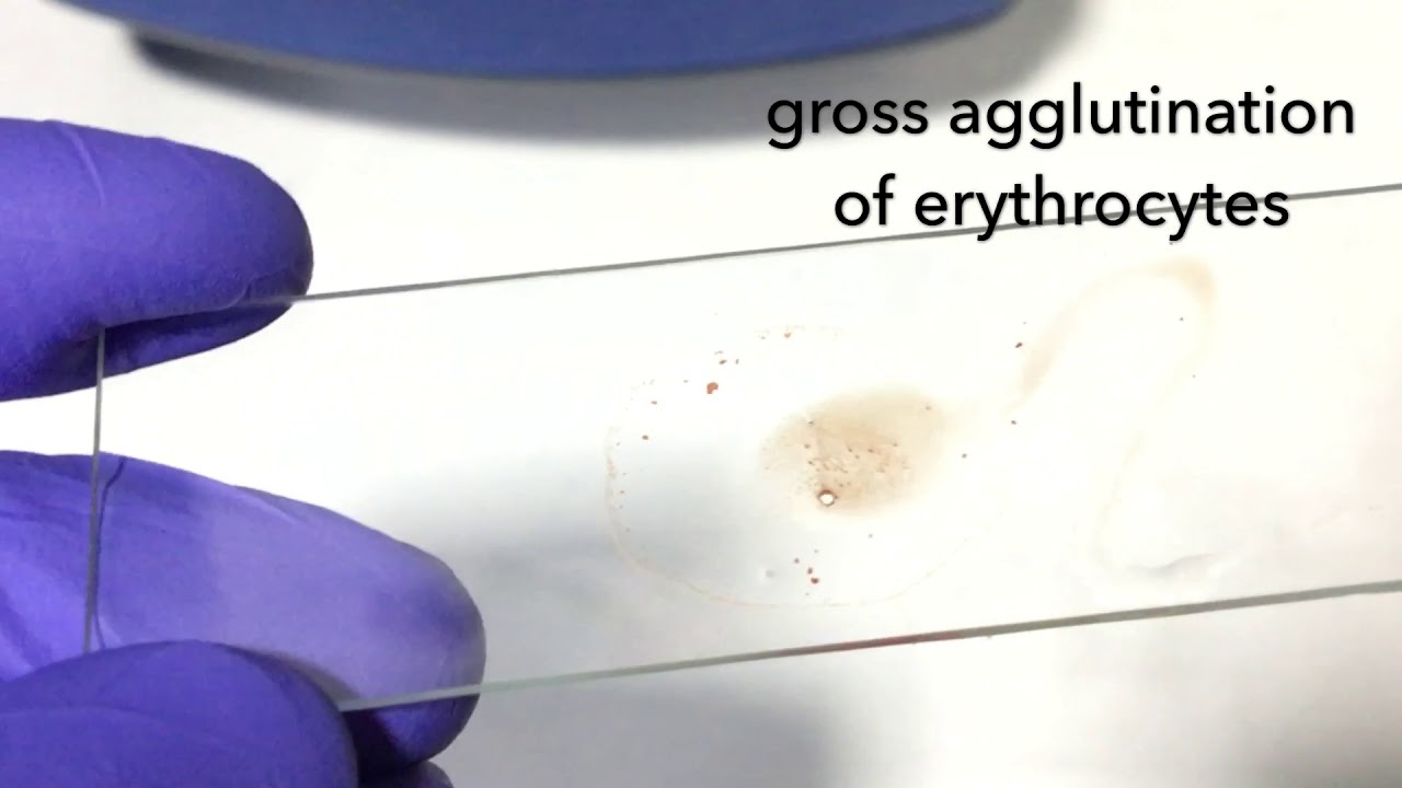 Slide agglutination test short video