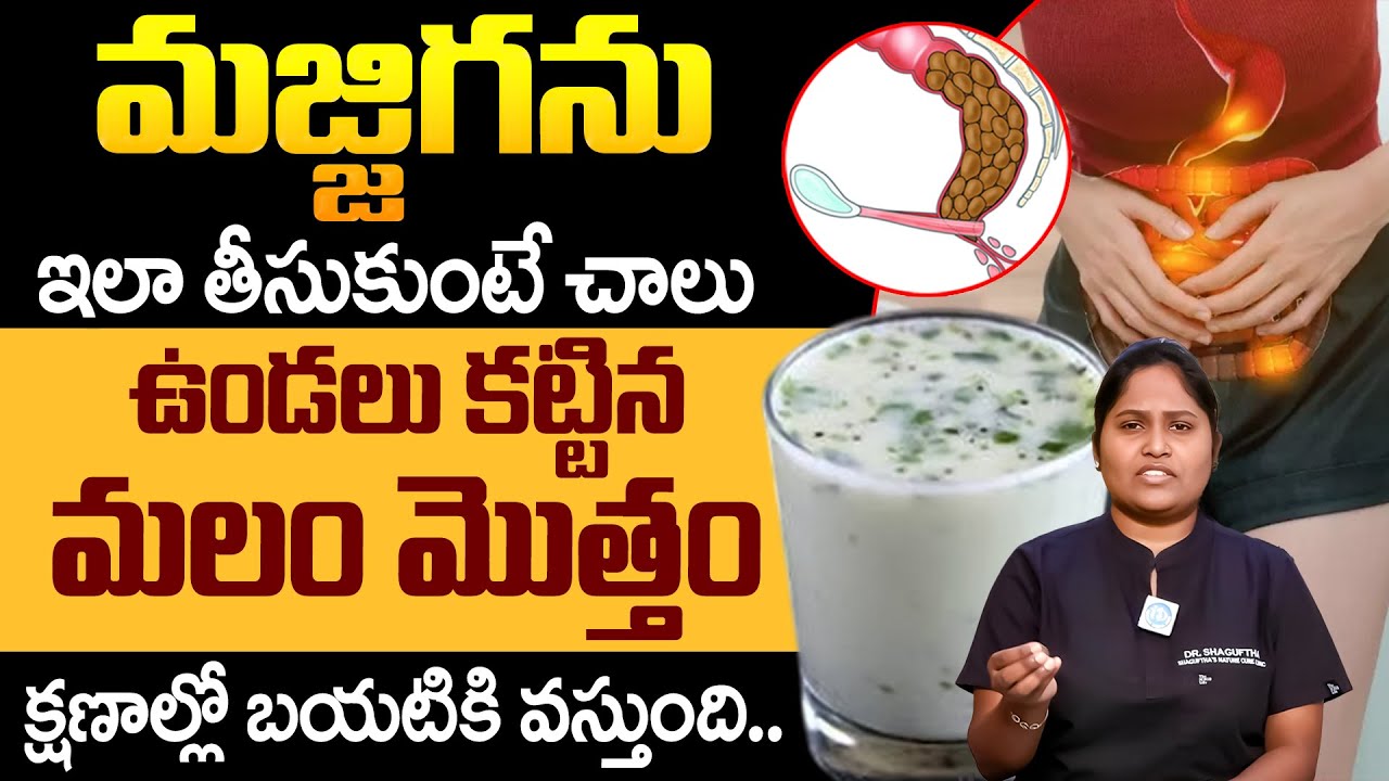 మజ్జిగను ఇలా తీసుకుంటే మలం తన్నుకుంటూ బయటకి వచ్చేస్తుంది | Constipation | Dr Shaguftha | iDream