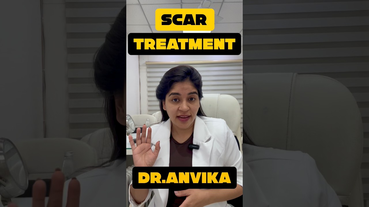 Acne Scar Treatment | pimples marks on face | how to remove face scars #acnescars