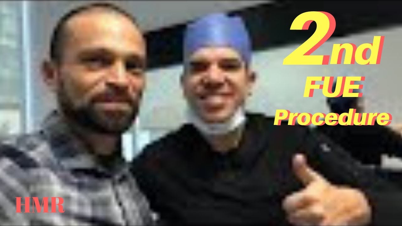 2nd FUE Procedure | Density Hair Transplant | Minoxidil | Hair Medical Restoration | Tijuana