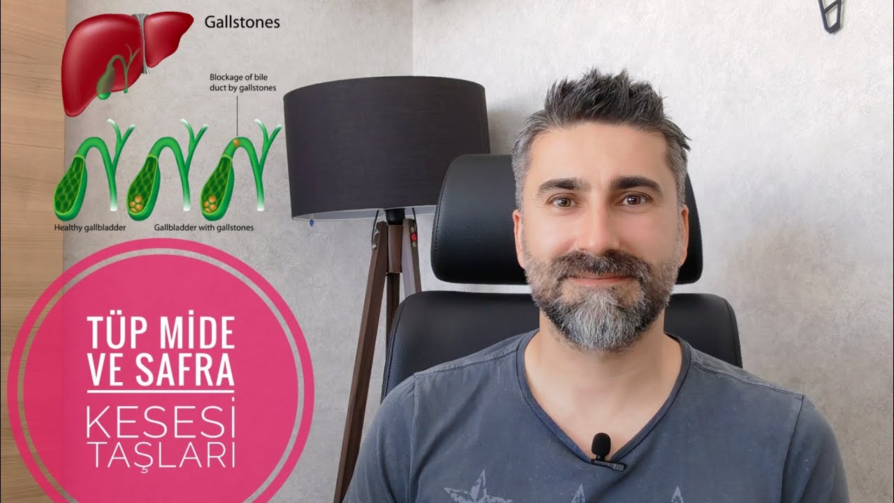 TÜP MİDE ameliyatı SAFRA kesesinde TAŞ yapar mı..? (obezite cerrahisi, gastrik bypass)