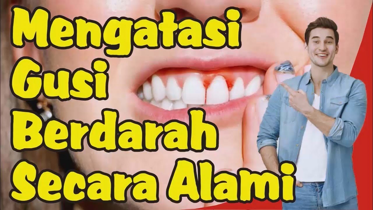 Cara Mengatasi Gusi Berdarah Secara Alami