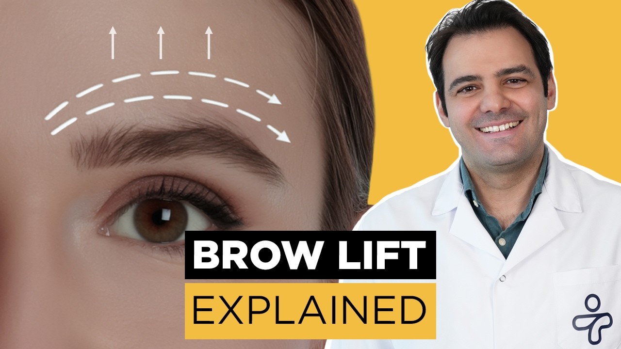 Brow Lift Surgery Explained, Gliding, Endoscopic, Hairline, Direct | Doctor Explains