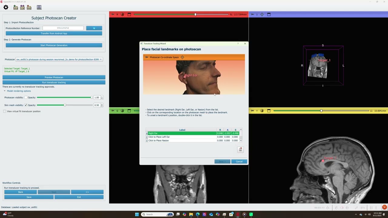 Openwater LIFU Tutorials Part 2: Aligning MRI with Render