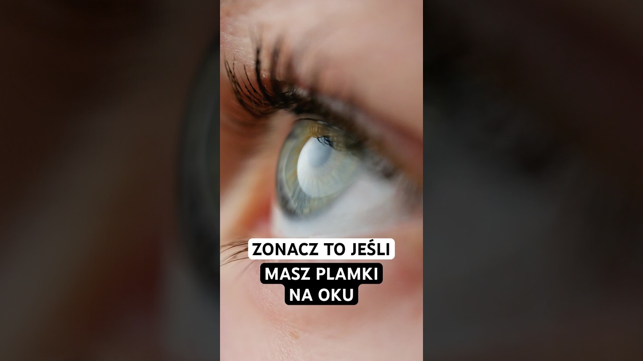 Czym są męty w oku? #zdrowie #okulista #wzrok #oczy