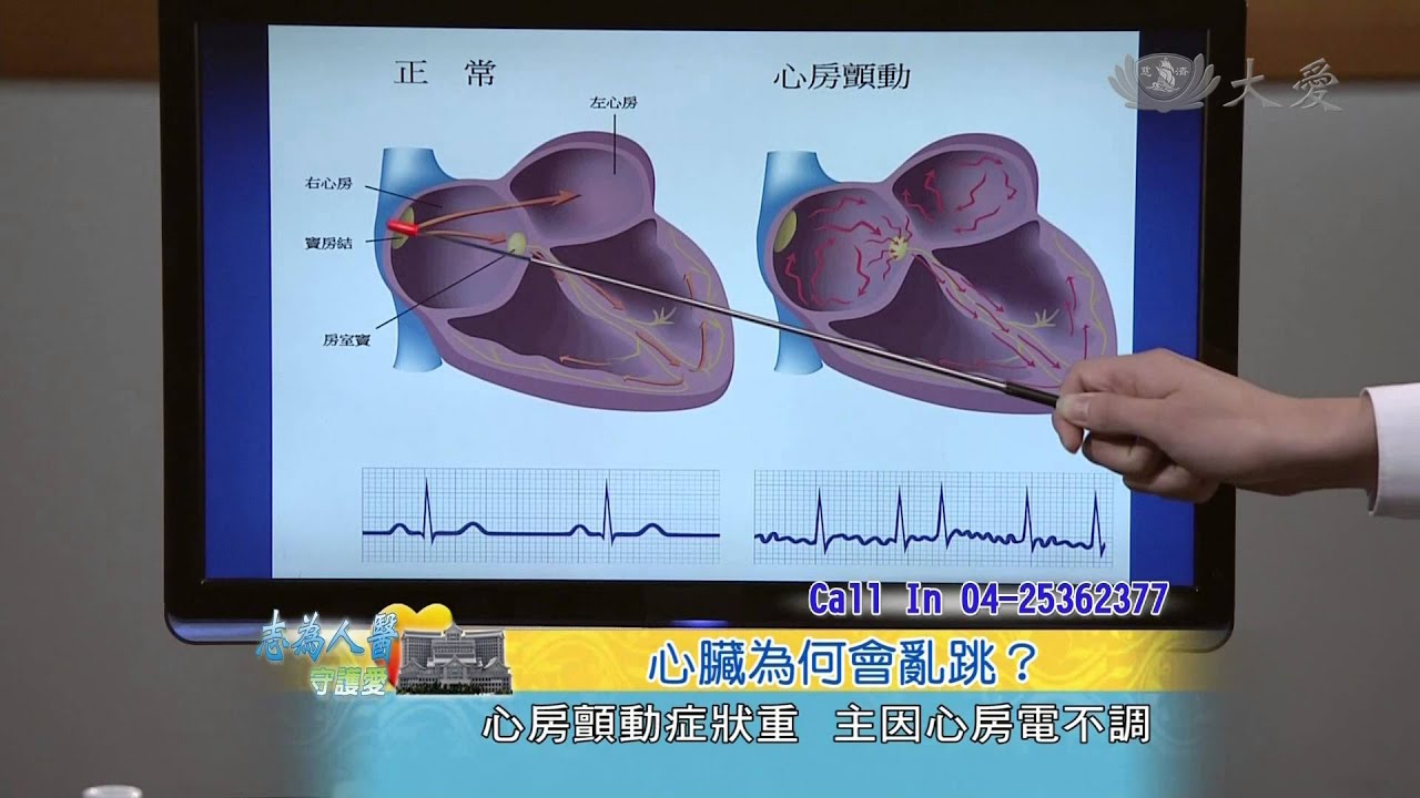 【志為人醫守護愛】20141223 - 心臟亂跳 心律不整的治療