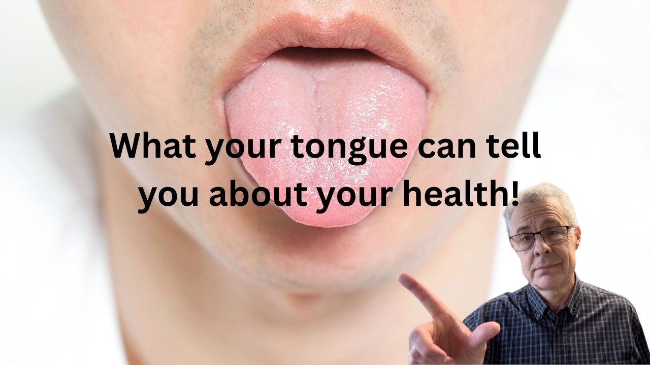 What your tounge can tell you about your health.