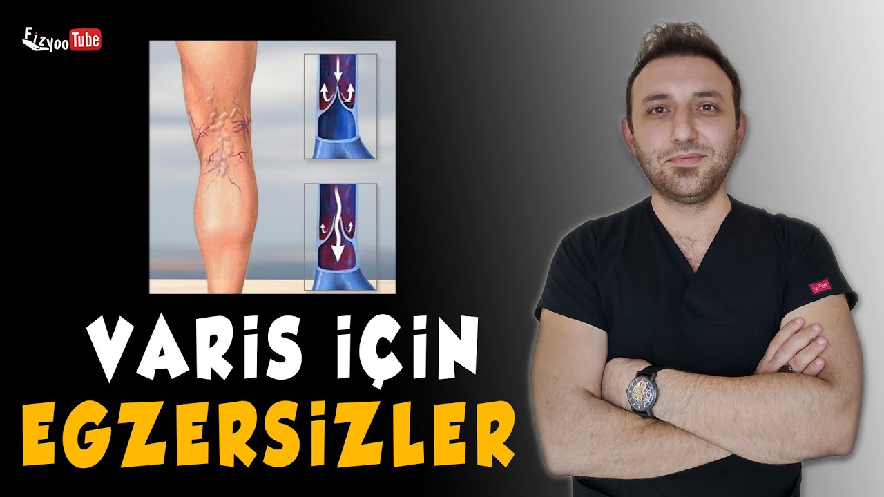 VARİS EGZERSİZLERİ | Bacak Şişliğini ve Ağrısını Gideren Önleyici Egzersizler (Fizyoterapist)