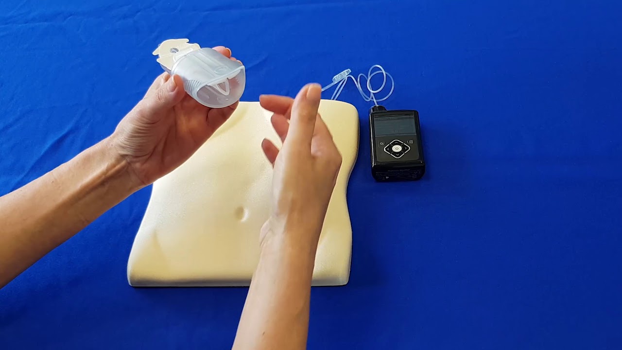 Set di infusione MiniMed™ Mio 30™ - Medtronic Diabetes Pompa per insulina