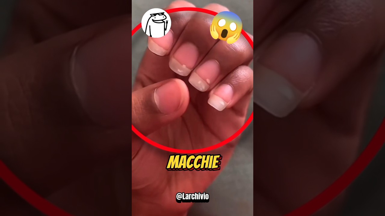 MACCHIE BIANCHE SULLE UNGHIE 😱 #science #curiosit&agrave;