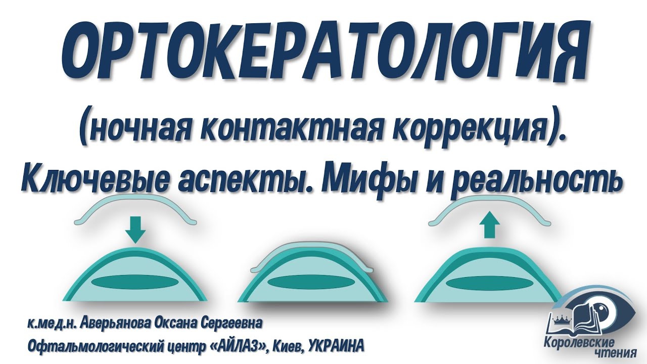 ОРТОКЕРАТОЛОГИЯ (ночная контактная коррекция). Ключевые аспекты. Мифы и реальность