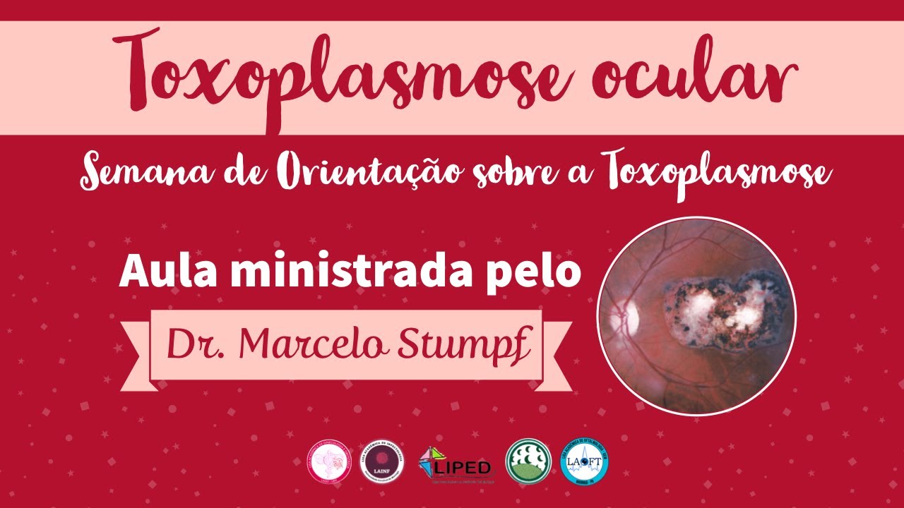 Toxoplasmose Ocular: Aula LAOFT-UEM