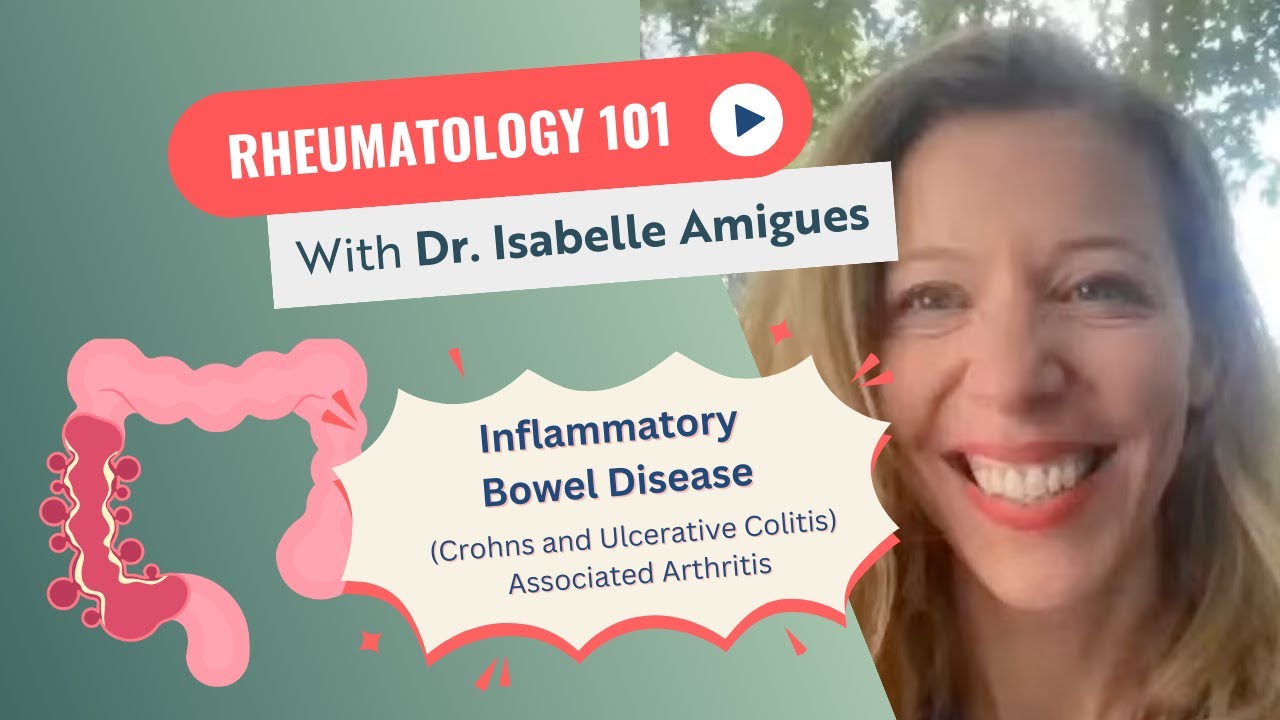 Inflammatory Bowel Disease (Crohns and Ulcerative Colitis) Associated Arthritis