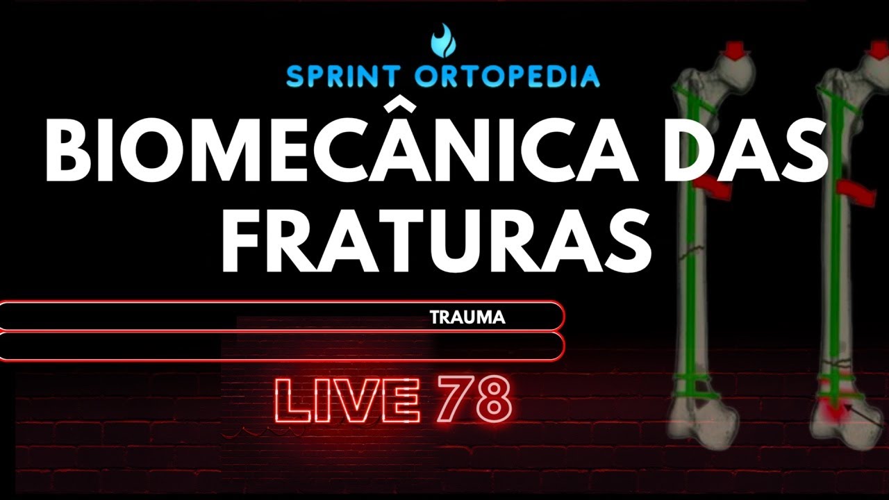 LIVE 78-  BIOMEC&Acirc;NICA DAS FRATURAS