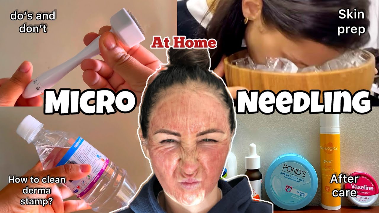 How to Use DERMA STAMP At Home| How to clean derma stamp ? | Skin prep & After care 🎀