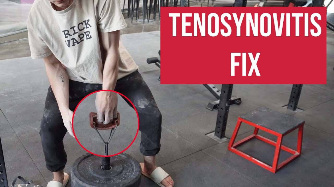 How I Got Rid of Tenosynovitis | Fixing Climber Finger Pain