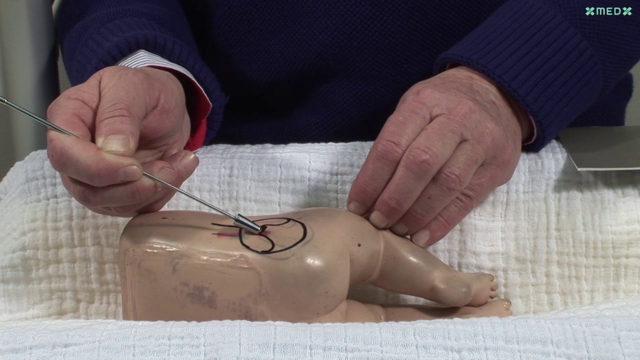 Baby Hip Ultrasound (Graf method) with Professor Dr. Reinhard Graf