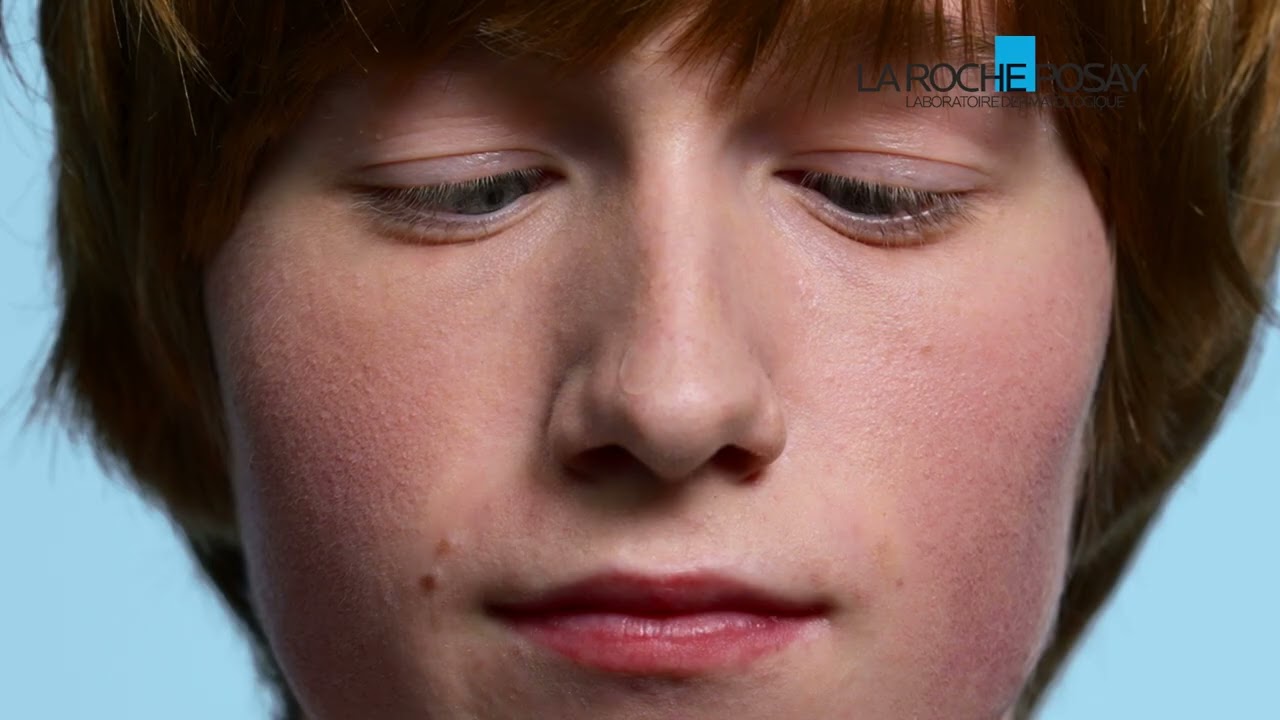 &iquest;BROTES REPENTINOS? NUEVO EFFACLAR DUO +M PARCHES PARA IMPERFECCIONES