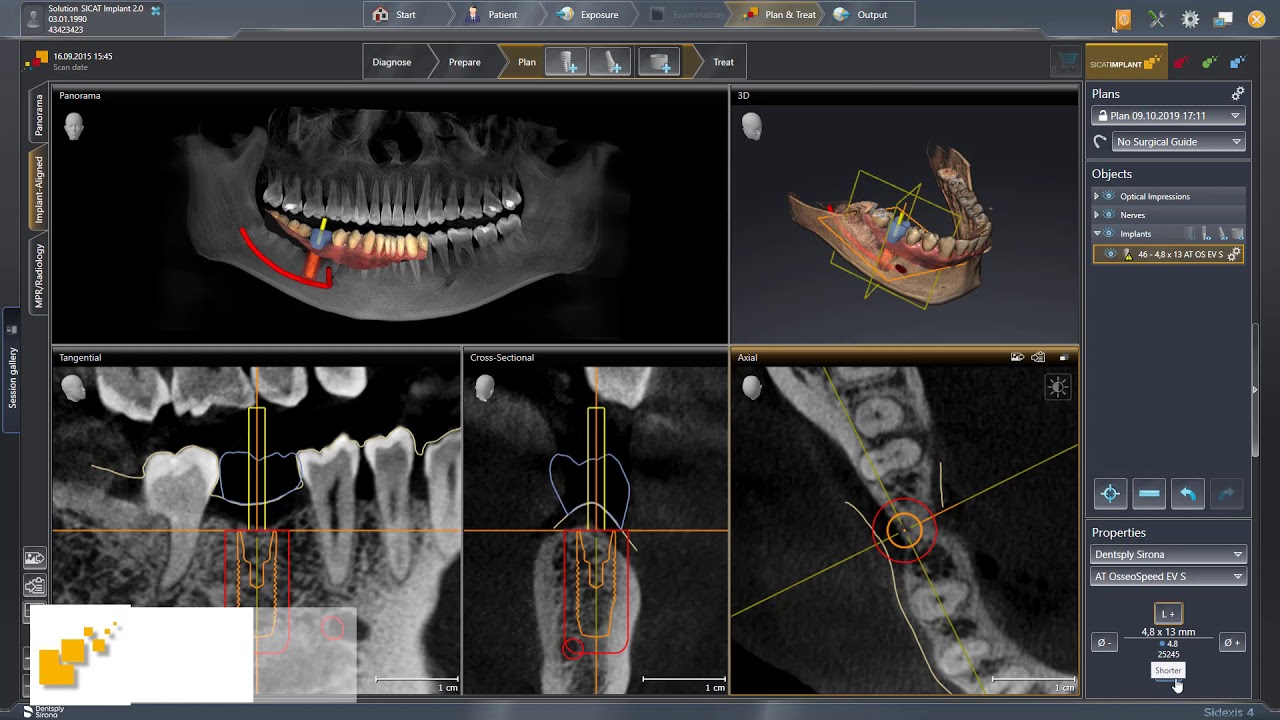 SICAT Implant 2.0 - Implant, Abutment & Sleeve Planning