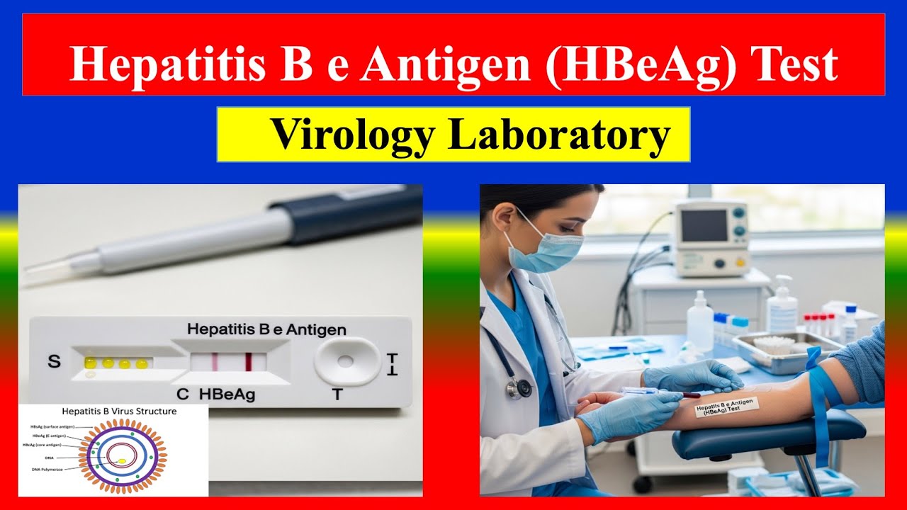 Hepatitis B e Antigen (HBeAg) Test - Definition , Uses ,Need, Preparation, Results , Normal Values