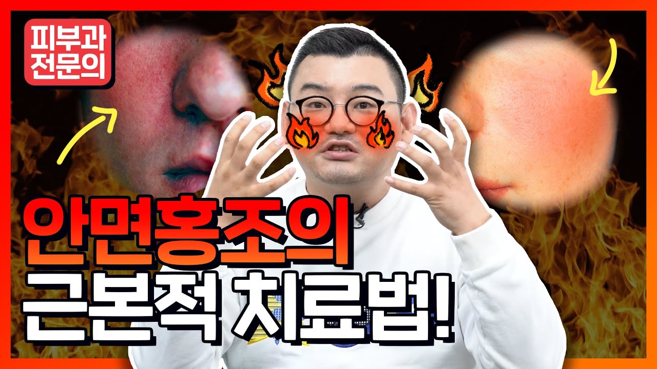 안면홍조🔥없애는법! 더이상 놀림받지 마세요! (근본적치료법)