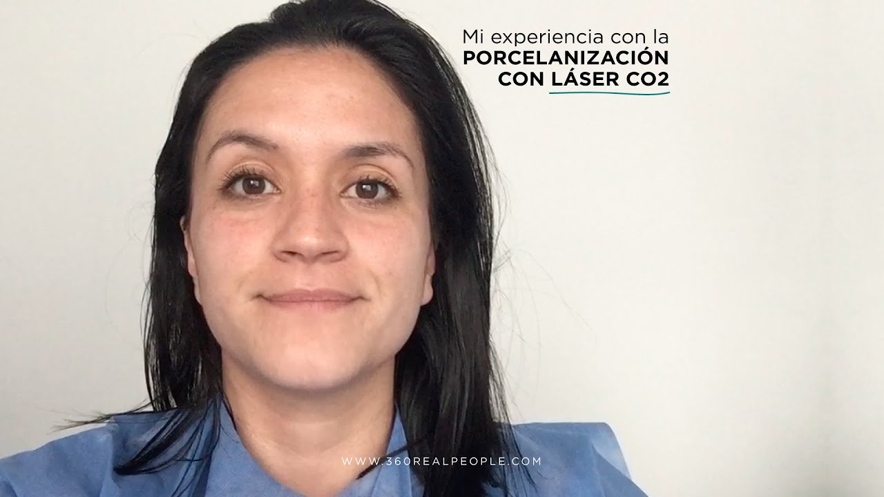 L&aacute;ser Co2 Fraccionado - Acn&eacute;, poros abiertos y cicatrices (experiencia paciente)