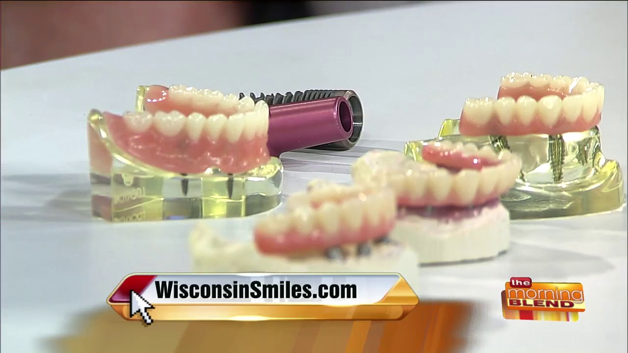 Your Different Options for Dental Implants