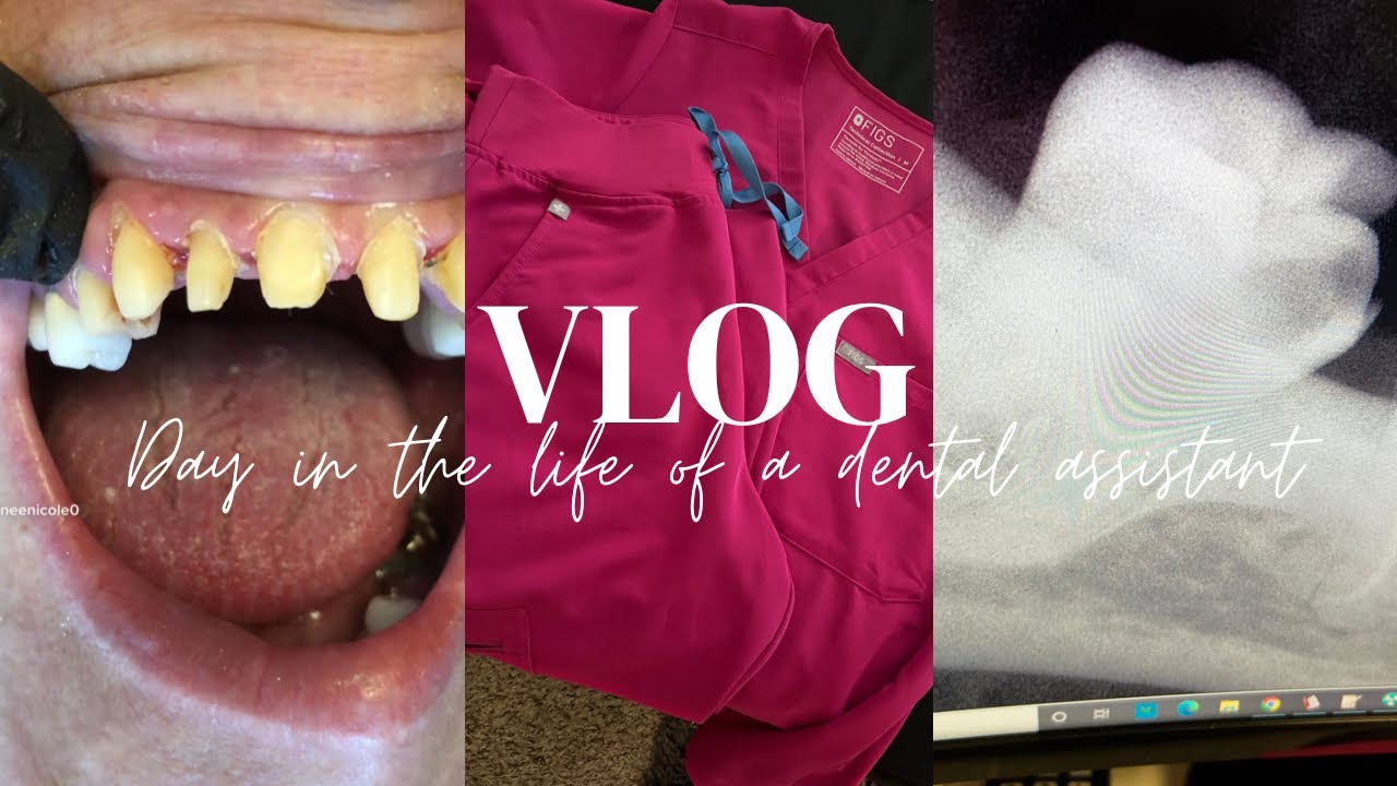 DAY IN THE LIFE OF A DENTAL ASSISTANT 🦷