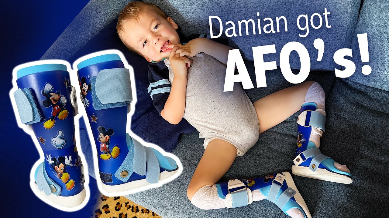 How They Made Custom AFO's (ankle braces) for My 2-Year-Old