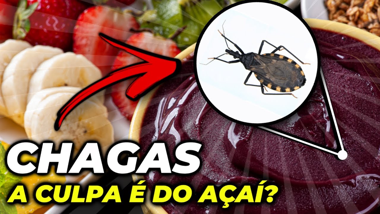 DOENÇA DE CHAGAS E O AÇAÍ : O QUE NUNCA TE CONTARAM