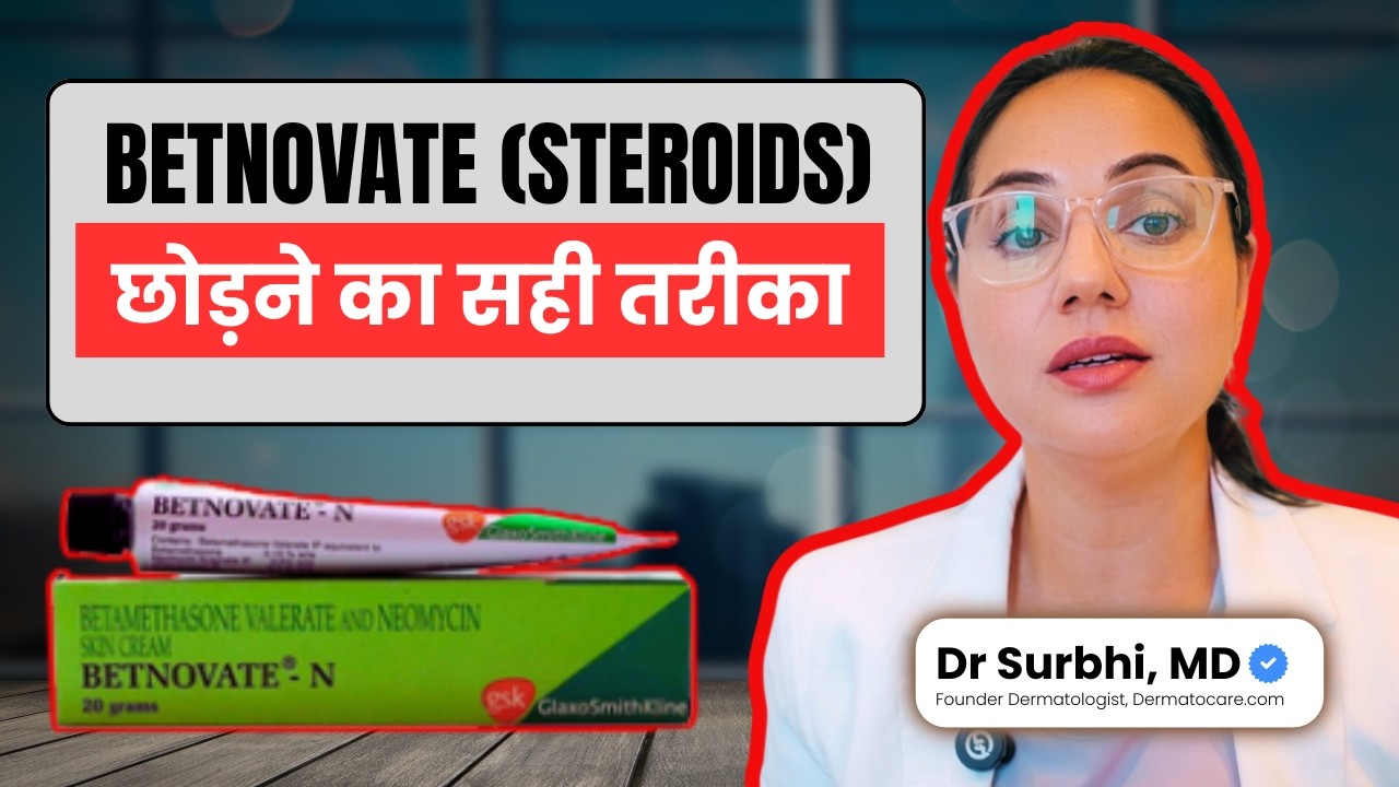 Betnovate छोड़ने का सही तरीका | Skin को नुकसान से बचाओ