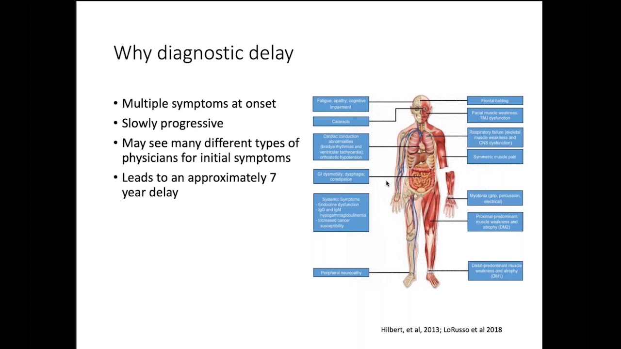 How Common is Myotonic Dystrophy in the United States? Findings from the Recent Prevalence Study