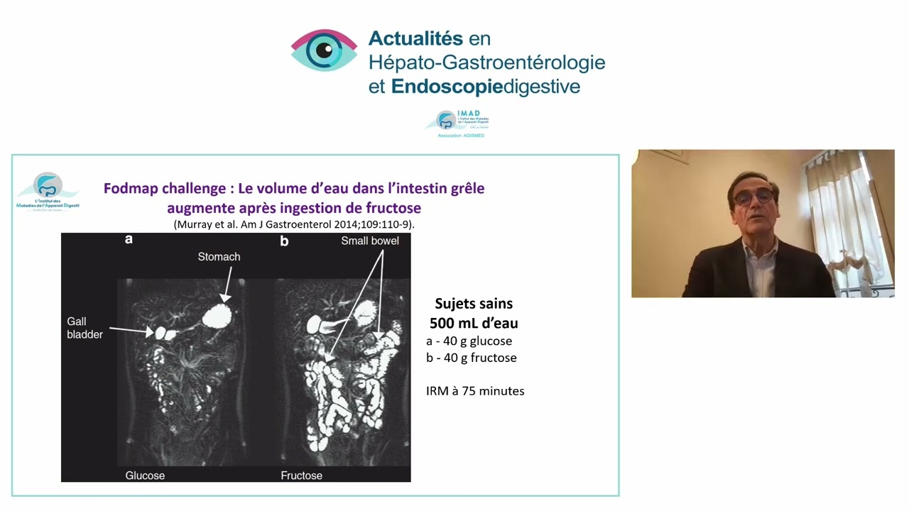 Syndrome de l'intestin irritable